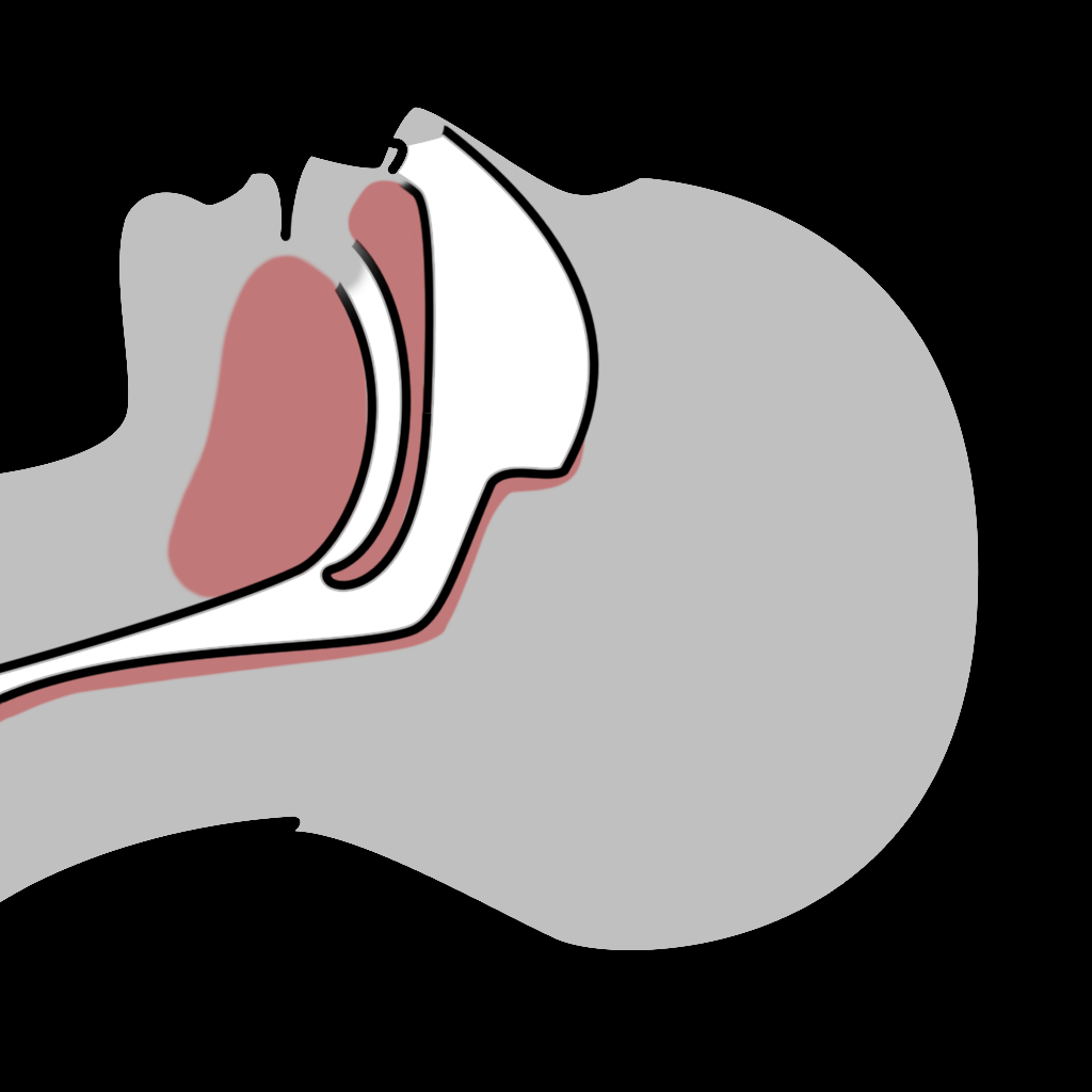 lying on back awake, soft palate and tongue stay in place