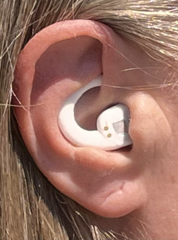 lying on back in deep sleep, soft palate and tongue collapse